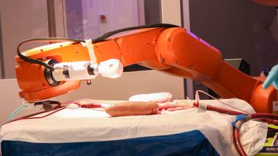 Minuscule robot kan patiënt straks afhelpen van bloedprop
