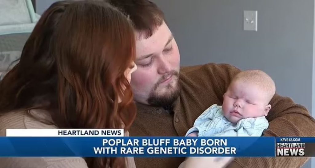 Parents stunned as baby girl born without EYES due to rare genetic disorder which only affects 30 people in world