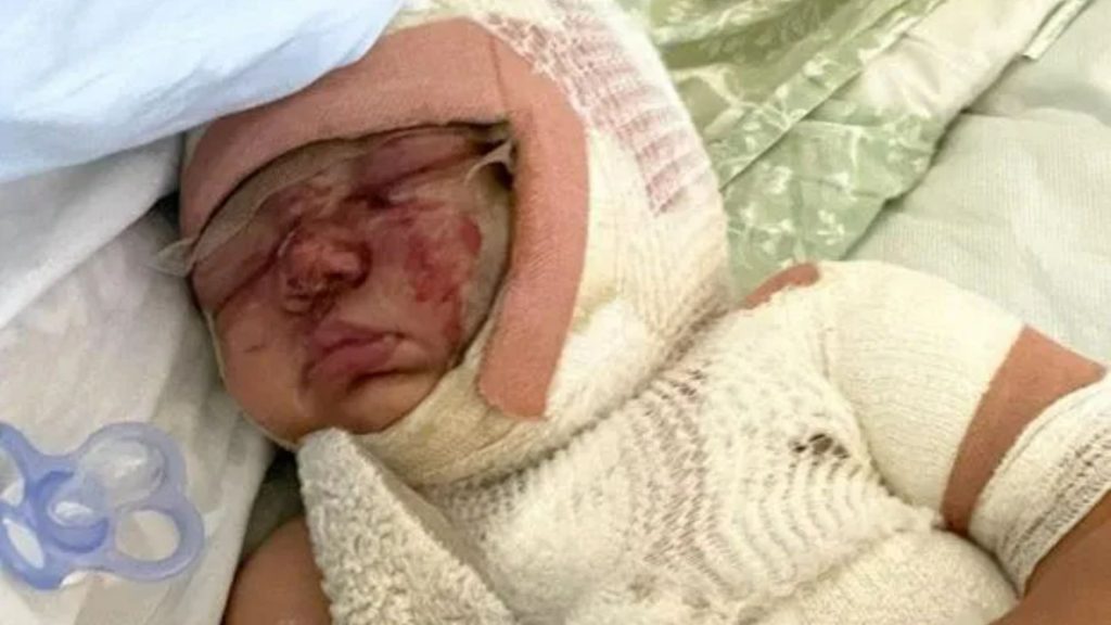 Mum shares heartbreaking photos of baby girl blinded and left with horrifying burns after 1st birthday party