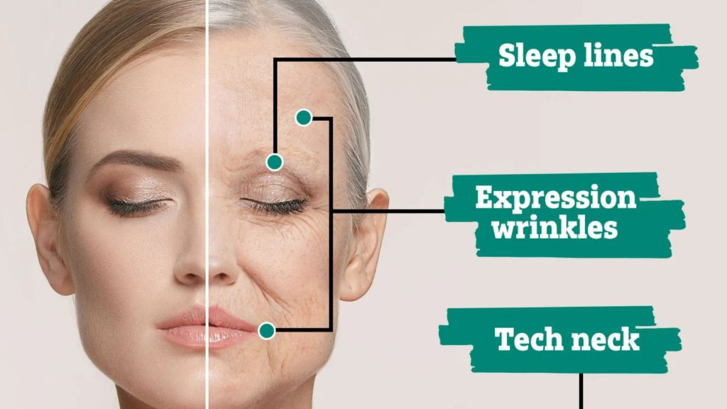 From crows feet to ‘bunny lines’ and ‘tech neck’ – what the location of your wrinkles means and how to combat them