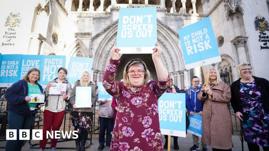 Rishi Sunak declines to back MP’s Down’s syndrome abortion law change