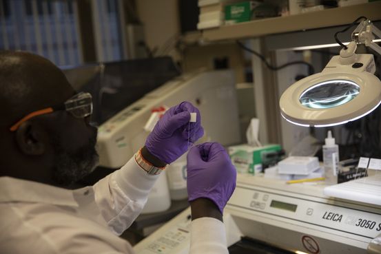 Eli Lilly Alzheimer's Drug Delayed as FDA Plans Advisory Panel Meeting