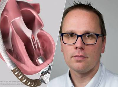 450 mensen hebben een steunhart: een pomp in je buik die werkt op batterijen en bloed weer rondpompt