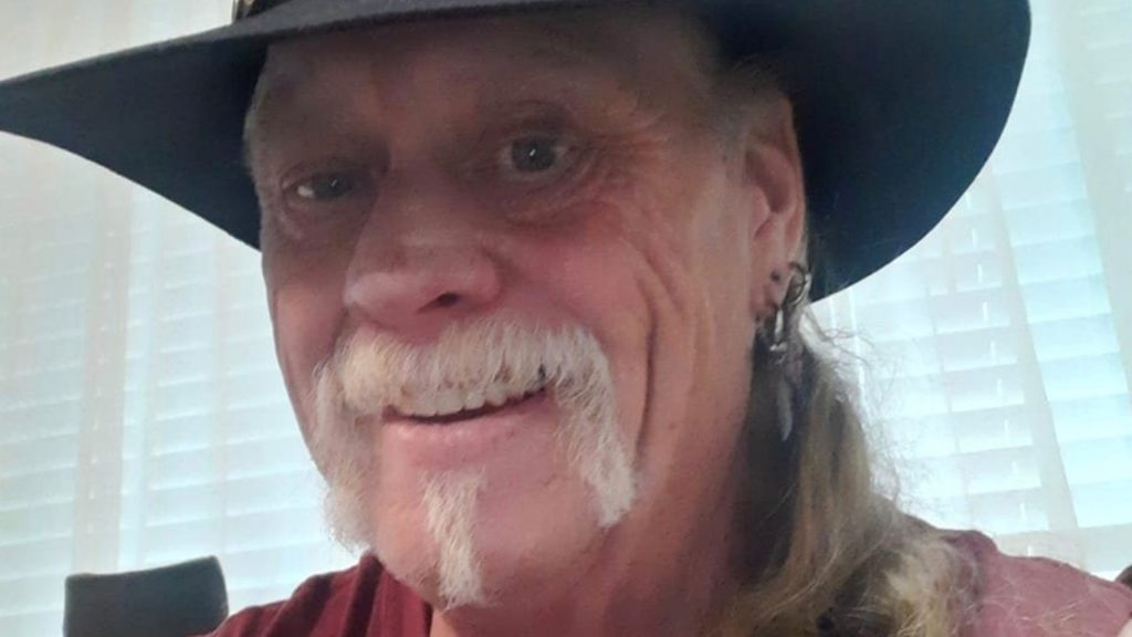 I’m one of 75 people in world with ‘demon face syndrome’ – three years ago I hit my head, now everyone terrifies me