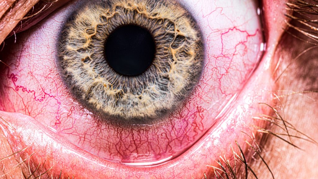How often you BLINK could be a sign of 7 debilitating health conditions – are you at risk?