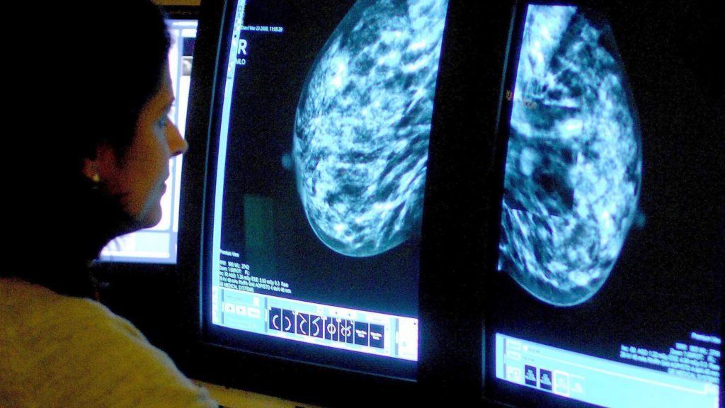 Thousands of women denied life-extending breast cancer drug because ‘it’s too pricey for NHS’