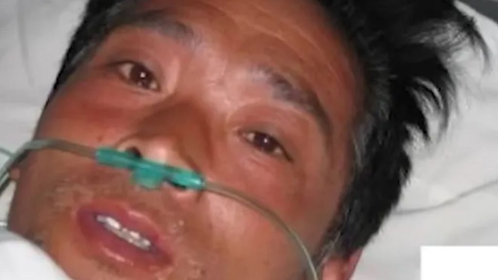 Nuke disaster turned worker into most radioactive man in history who cried blood as skin melted…but docs kept him alive