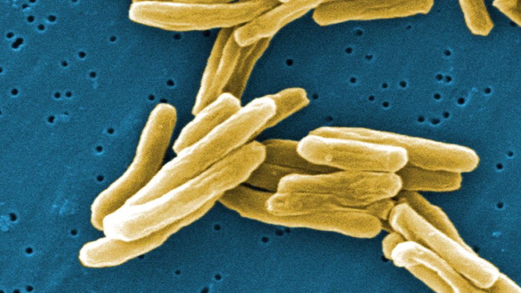 Many people ill with ‘world’s deadliest disease’ feel WELL, scientists warn