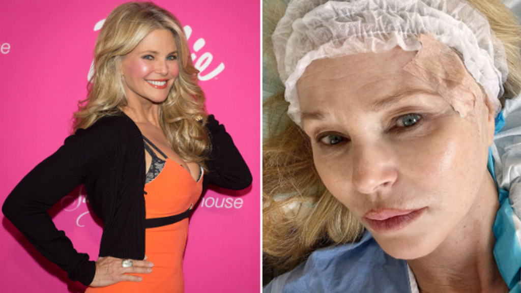 Supermodel Christie Brinkley reveals skin cancer diagnosis | Ents & Arts News