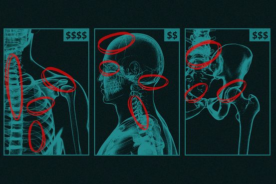 Insurers Pocketed $50 Billion From Medicare for Diseases No Doctor Treated