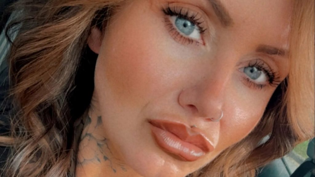 ‘It was like a sledgehammer to my skull,’ says mum, 38, left in agony after £20 ‘skinny jab’ she bought on Facebook