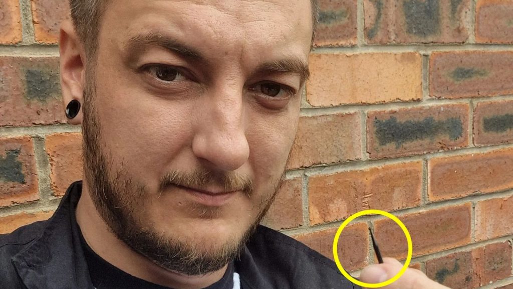 I’m traumatised after a dentist dropped a drill bit down my throat – it was left inside me for NINE WEEKS