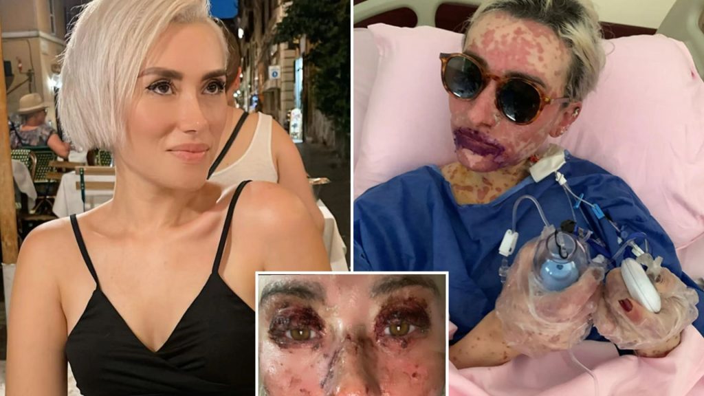 I was burned from the inside out and temporarily blinded after taking drugs to ease my anxiety