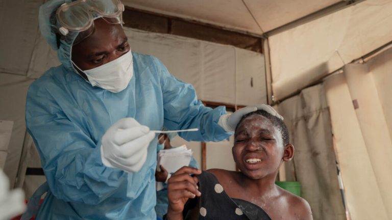 African countries seek to contain spread of Mpox