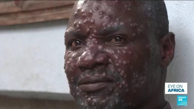 Africa's top health body sounds alarm over mpox outbreak