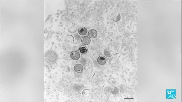 Europe must prepare for more mpox cases, EU health agency warns
