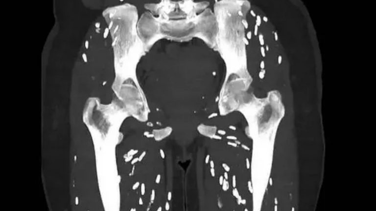 Disturbing scans reveal why you must always wash your hands properly after using the toilet