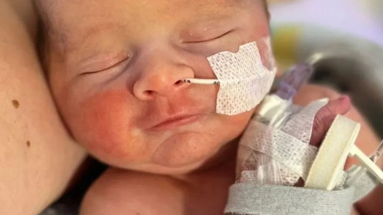 My baby was attacked in the womb by my immune system which thought he was a foreign object