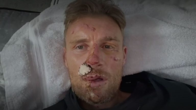 Freddie Flintoff reveals extent of injuries after Top Gear crash | Ents & Arts News