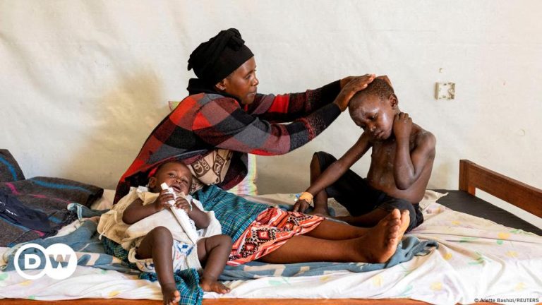 Mpox doses to start to arrive in Congo – DW – 09/05/2024