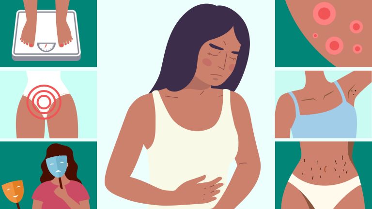 From carb cravings to spots on your jawline – the 8 signs of PCOS you didn’t know as 1 in 10 women suffer