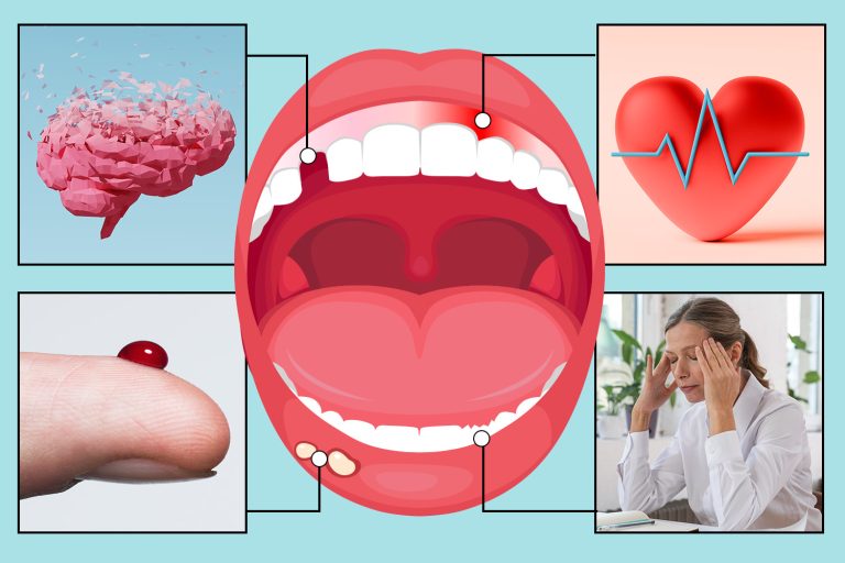 The 10 things your TEETH can reveal about your health – from silent killers to dementia