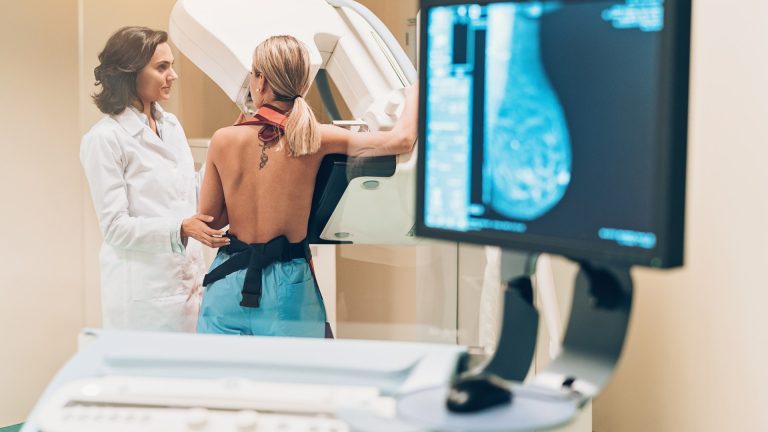 Women will be able to self-refer for breast cancer scans WITHOUT seeing a GP in major NHS overhaul – The Sun