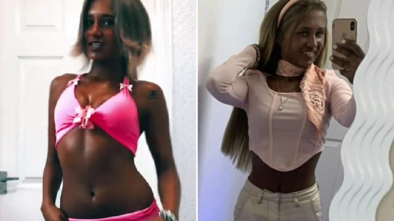 I’m so addicted to sunbeds trolls call me a ‘dirty 2p piece’ – I‘ve got a dodgy ‘mole’ but I’m scared to see a doctor