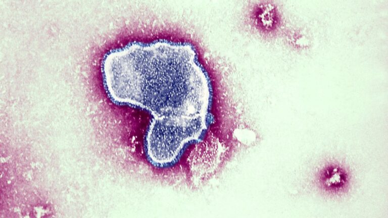 Surge in killer lung virus fuels ‘tripledemic’ fears – as new threat emerges ‘targeting the young’
