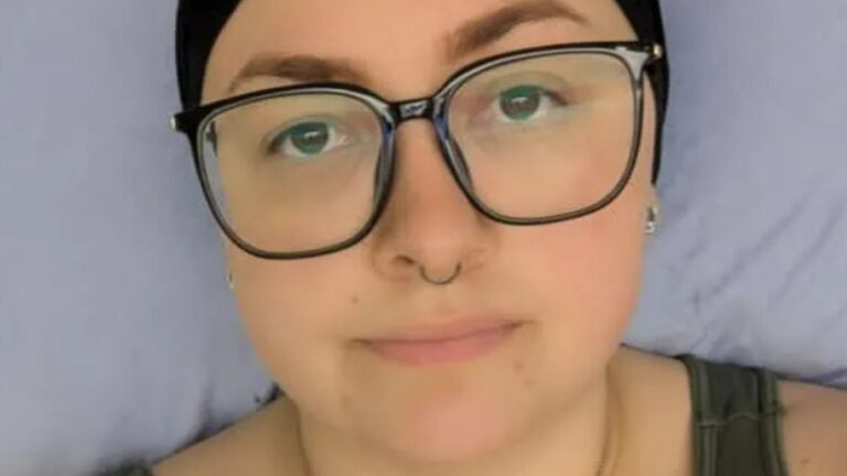 I thought my cancer symptoms were eczema for three years – I’m now stage 4 and beyond broken