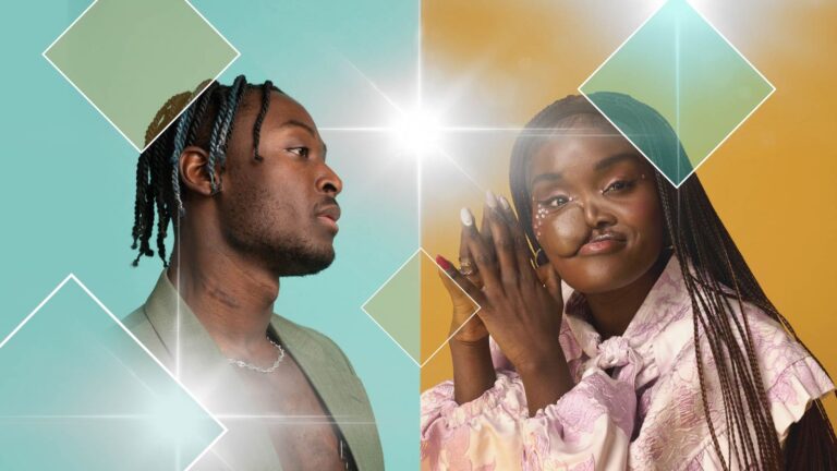 What if Romeo had a scar? Or Juliet a facial difference? The actors challenging screen conventions | Ents & Arts News