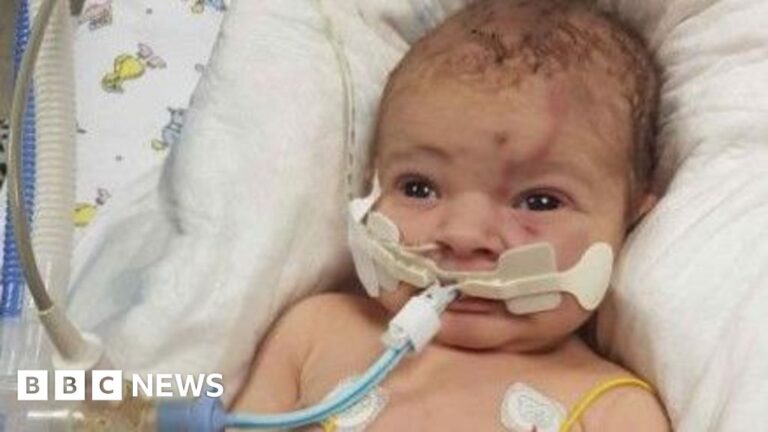 Leeds maternity inquiry must include care culture, says father