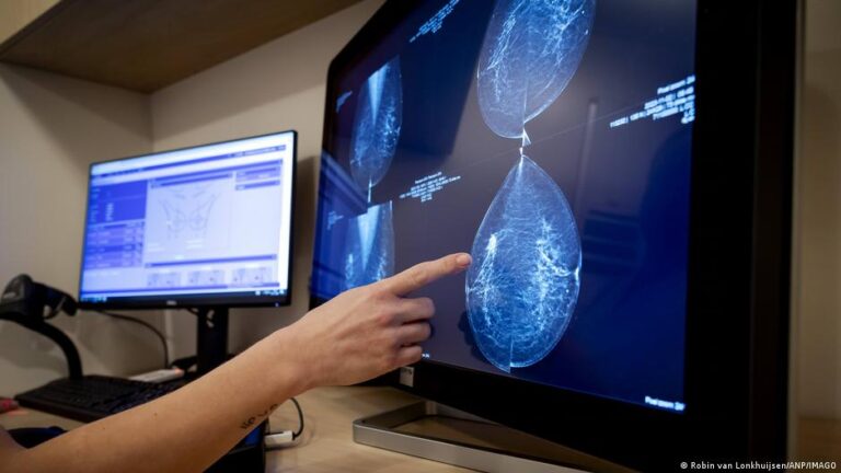 New AI model can predict 5-year breast cancer risk – DW – 12/07/2025