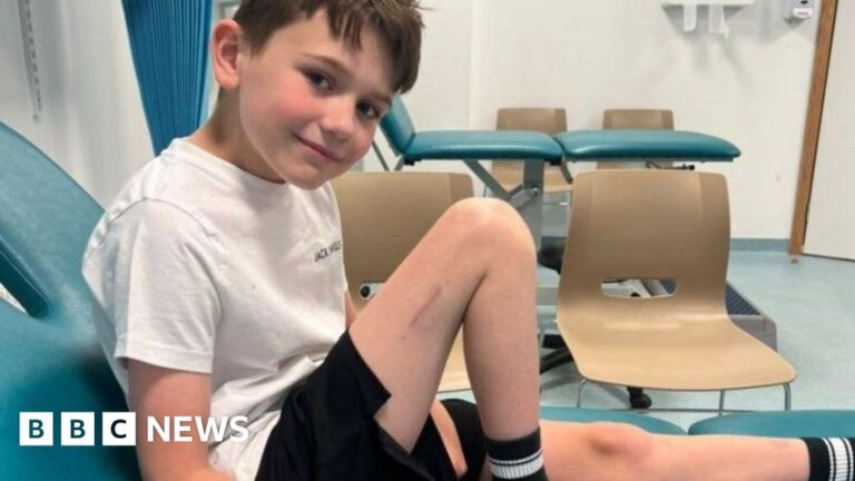 Boy first in UK to have surgery to make him taller