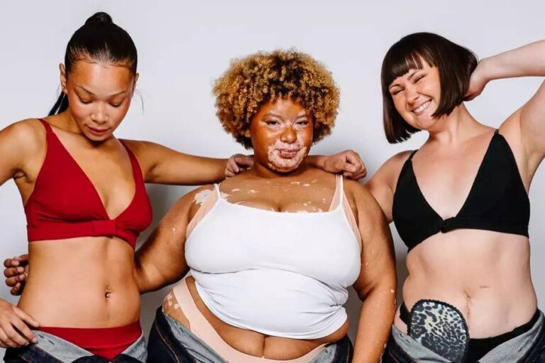 Britse ontwerpster lanceert catwalkshow voor disability pride om modenormen uit te dagen